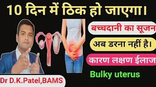 10 दिन में ठिक हो जाएगा|बच्चदानी का सूजन|Bachedani me sujan ka ilaj|Bulky uterus kaise thik kare