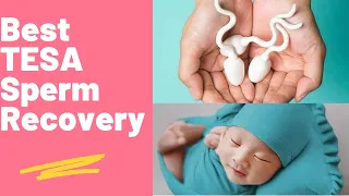 TESA SPERM RECOVERY TESTICULAR SPERM for#icsi #maleinfertility 
#infertility #ivfsuccess #ivfbabies