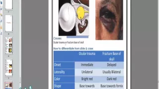 Practical Ophthalmology - Trauma, Tumors and Uvea