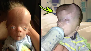 10 Most UNUSUAL Babies In The World