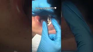 Can You Really Tattoo Your TEETH?! 😳🦷