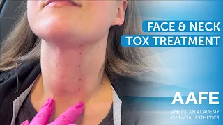 Face & Neck Tox Treatment