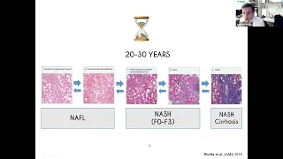 March 29 2022   MAFLD diagnosis and management   webinar recording