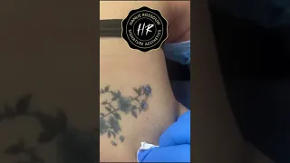 Plasma Tattoo Removal #shorts