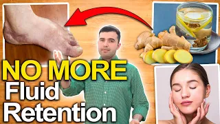 How To Eliminate Fluid Retention - Reduce Excess Water With Home Remedies