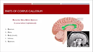 Mnemonic for Parts of Corpus Callosum - Cerebral Angio-graphy Tricks 03