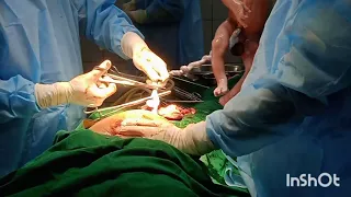 C-Section (Cesarean Delivery) || 36 Weeks Of Pregnency Delivery ❤️