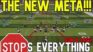 BEST DEFENSE (POST PATCH) in Madden NFL 24! Stops Everything RUN & PASS! Best Plays Tips & Tricks