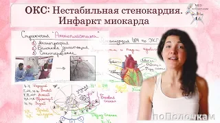 Острый коронарный синдром (ОКС): Инфаркт и нестабильная стенокардия