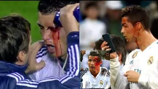 Cristiano Ronaldo ► Top 5 Horror Injuries ever in his Career | HD.#cr7