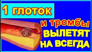 ЭТОТ НАПИТОК из 7 ТРАВ МОМЕНТАЛЬНО РАСТВОРИТ ТРОМБЫ Чистка сосудов от холестерина в домашних условия