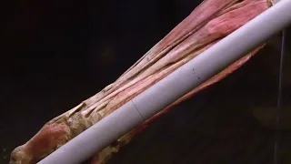 Body Worlds exhibit opens at Moody Gardens