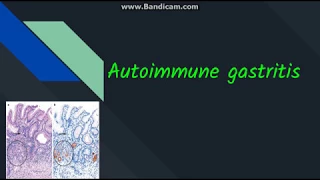 Autoimmune gastritis