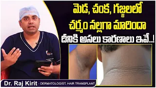 చర్మం నల్లగా మారిందా | Symptoms and Causes of Acanthosis Nigricans in Telugu | Celestee Skin Clinic