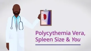 Polycythemia Vera, Spleen Size & You