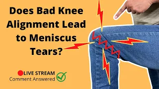 Can A Knee Alignment Problem Cause A Meniscus Tear?