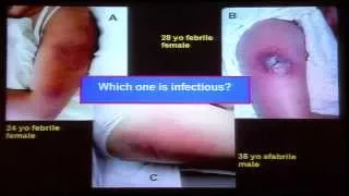 Infectious Diseases:  Are We Losing Our Ability to Treat?