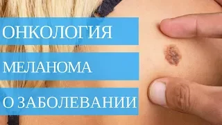 МЕЛАНОМА ➤ рак кожи🏥 Симптомы, диагностика лечение!