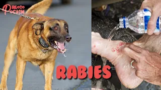 You Might Have Rabies And You Don't Know