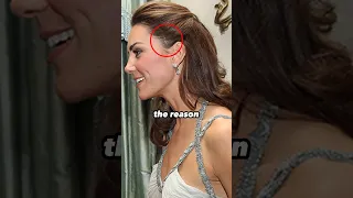 The Reason Behind Mysterious Scar On Catherine's Face #shorts #katemiddleton #kate