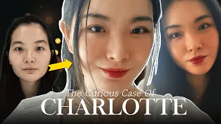 Charlotte's PLASTIC SURGERY journey at BRAUN✨ (Part 2) (Facial contouring,  double eyelid surgery)