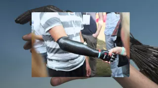 Бионический протез руки/Bionic prosthetic hand