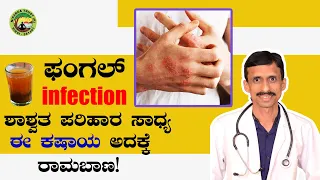 ARE YOU SUFFERING FROM FUNGAL INFECTION? HERE IS A NATURAL REMEDY | DR.VINAYAKHEBBAR