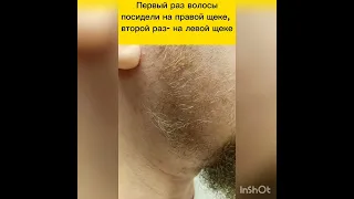 Поседел от пыток. Финские спецслужбы запытали до полусмерти.