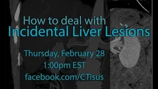 Facebook Live: How to Deal with Incidental Liver Lesions