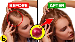 15 Natural Solutions To Promote Hair Growth And Thickness