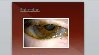 eyelid disorders