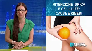 Ritenzione idrica e cellulite: cause e rimedi