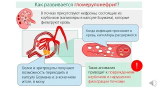 4 курс СФ. Лекция на тему: "Гломерулонефриты".