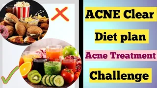 Best acne diet plan| Hormonal acne diet in hindi@dr.bilquisshaikh7437