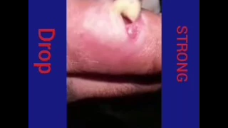 Pus filled pussy popper