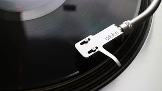 Simply Red - For Your Babies (2016 HQ Vinyl Rip) - Technics 1200G / Audio Technica ART9