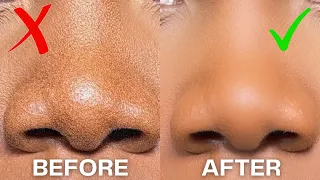 How to STOP Makeup From Separating From Your Nose