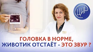 Развитие плода в 33.4 недели. Головка в норме, а животик отстаёт - это ЗВУР? Дементьева С.Н.