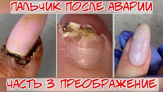 Преображение 3❤️ Восстановление ногтя после травмы 🔥 Финал 🔥 наращивание ногтей гелем