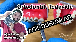 Ortodontik Tedavide Acil Durumlar - Telim çıktı ne yapmalıyım? - Dr.Oğuz Şahan