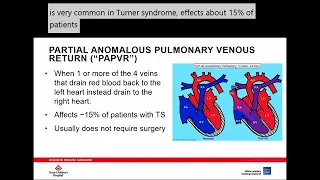 Cardiology Overview for Children and Adults with TS 2023