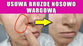 Jak w prosty sposób pozbyć się bruzdy nosowo wargowej