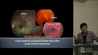 Acute Retinal Ischemia: An Emergency often Ignored - Valérie Biousse, MD
