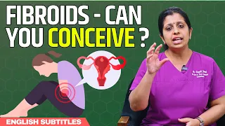 Can you get pregnant with fibroids | ஃபைப்ராய்டு கட்டிகள் இருந்தால் கருத்தரிப்பது பாதிக்கப்படுமா?