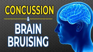 Traumatic Brain Injury | Do Concussions Cause Brain Bruising?