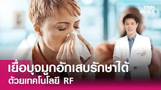 เยื่อบุจมูกอักเสบรักษาได้ ด้วยเทคโนโลยี RF : Daily Health