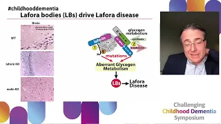 Pre-clinical treatments for Lafora disease - a childhood dementia driven by perturbed metabolism