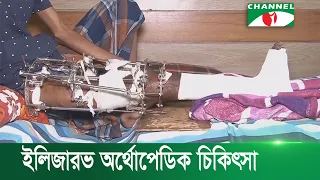 ইলিজারভ চিকিৎসা পদ্ধতিতে জন্মগত বাঁকা হাড়ের ত্রুটি সারানো সম্ভব