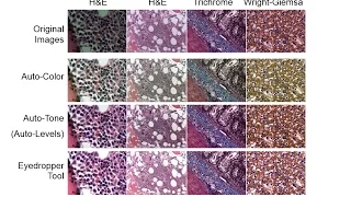 Webinar: A Better Choice than Photoshop for Color Brightfield Microscope Images