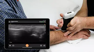 Ultrasound of the Wrist